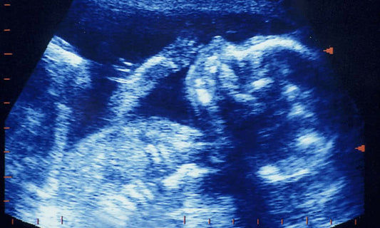 Men are affected by the biological clock as well